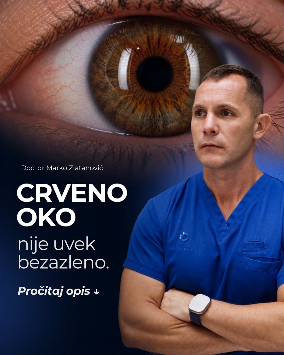 Crveno oko koje nije bezazleno: hitan očni pregled u Nišu