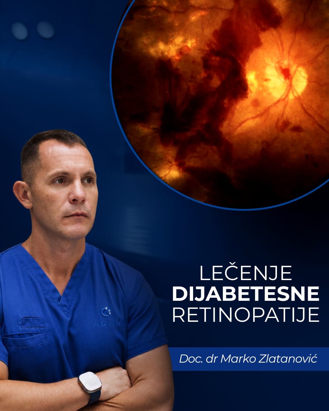 Snimak očnog dna sa promenama kod dijabetesne retinopatije