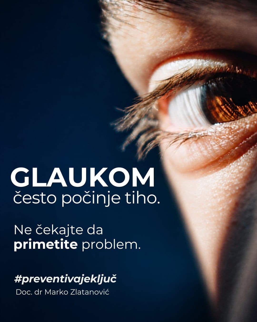 Krupan kadar oka uz poruku da glaukom počinje tiho, bez simptoma