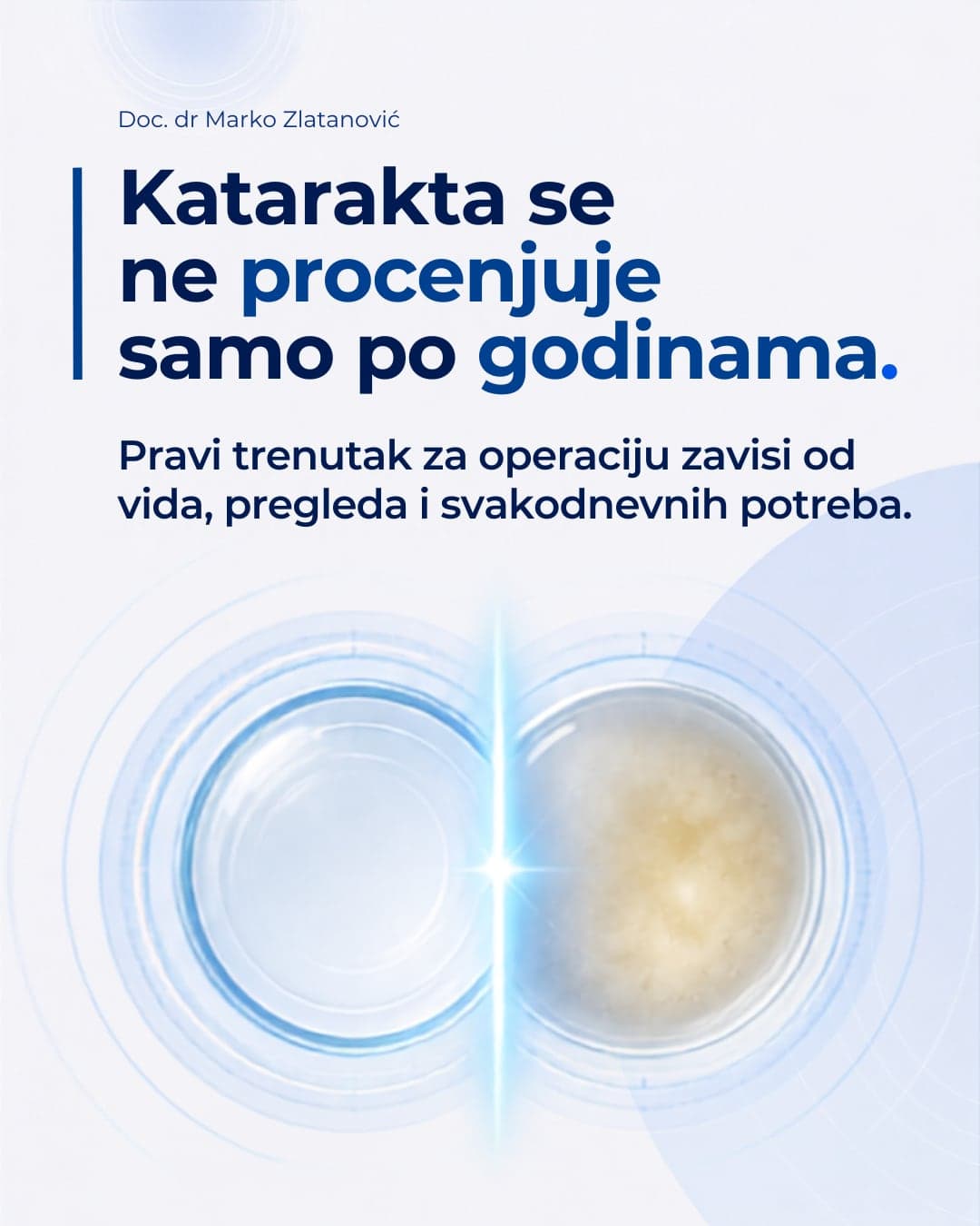 Poređenje bistrog i zamućenog očnog sočiva kod katarakte