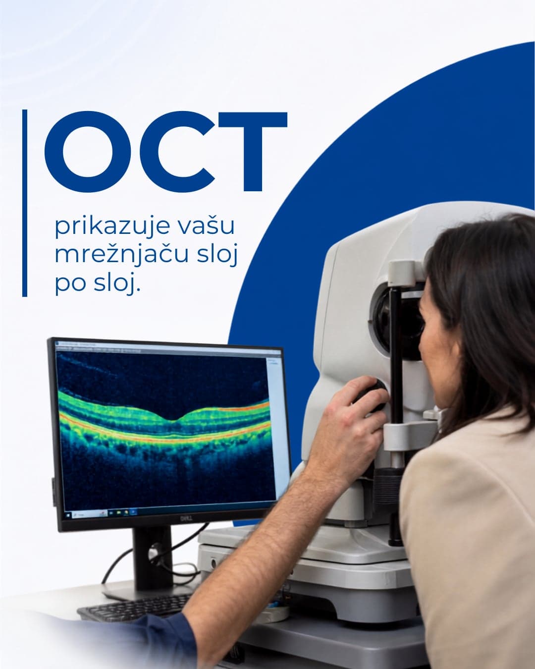 OCT pregled: snimak mrežnjače koji vidi ono što oko ne oseti