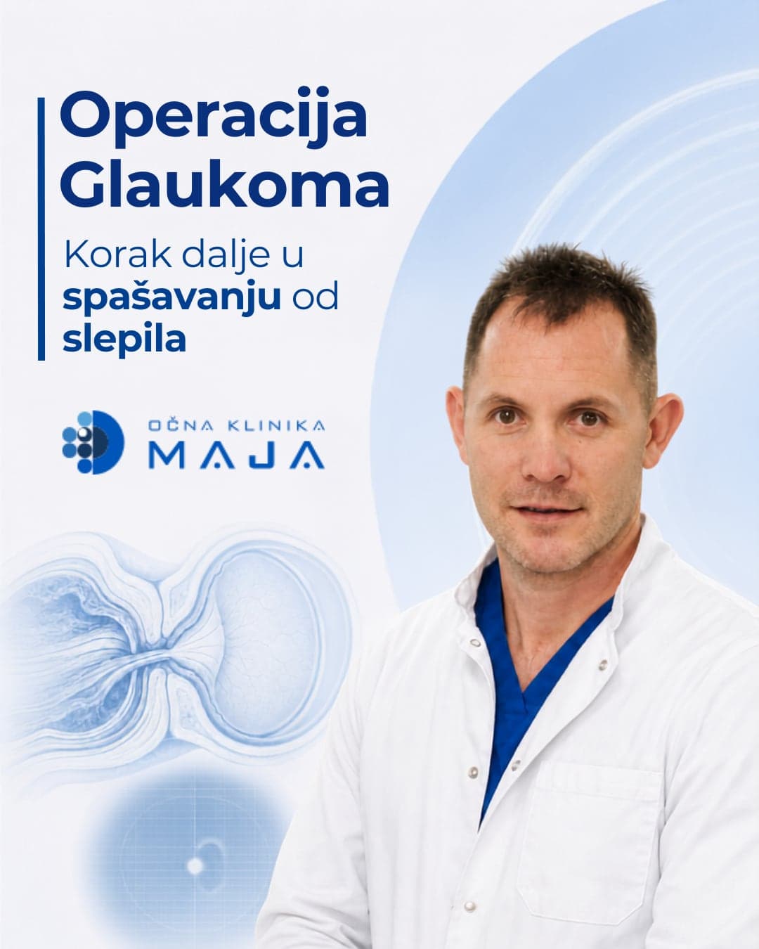 Doc. dr Marko Zlatanović, operacija glaukoma u Klinici Maja u Nišu